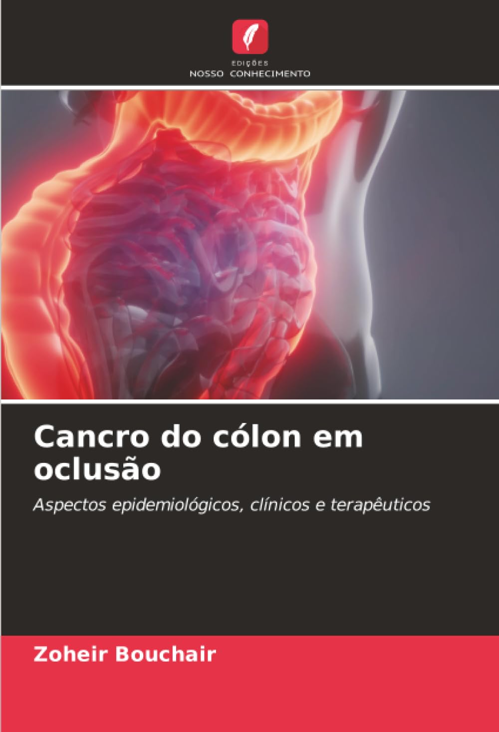 Cancro do cólon em oclusão: Aspectos epidemiológicos, clínicos e terapêuticos