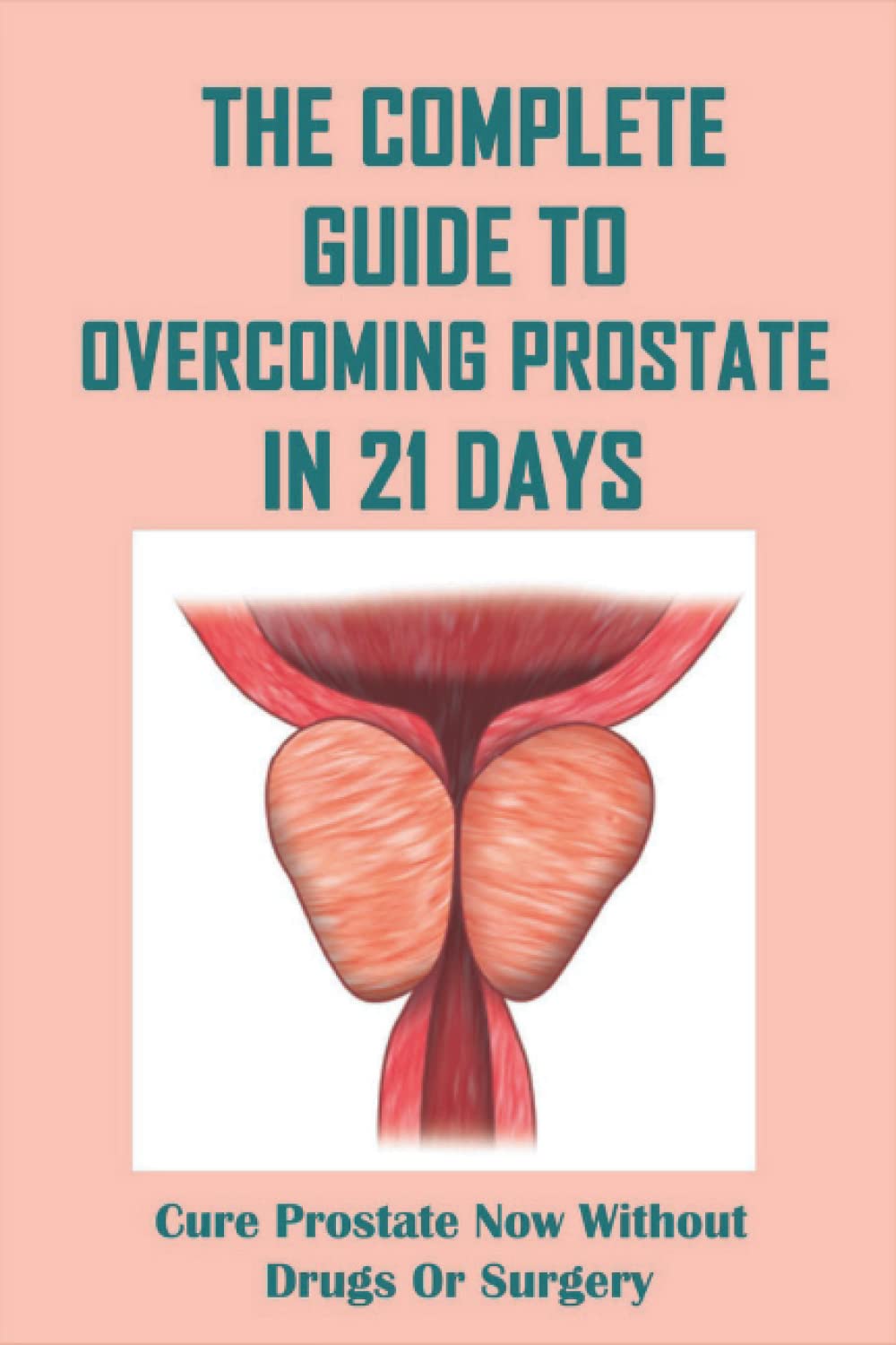 The Complete Guide To Overcoming Prostate In 21 Days: Cure Prostate Now Without Drugs Or Surgery