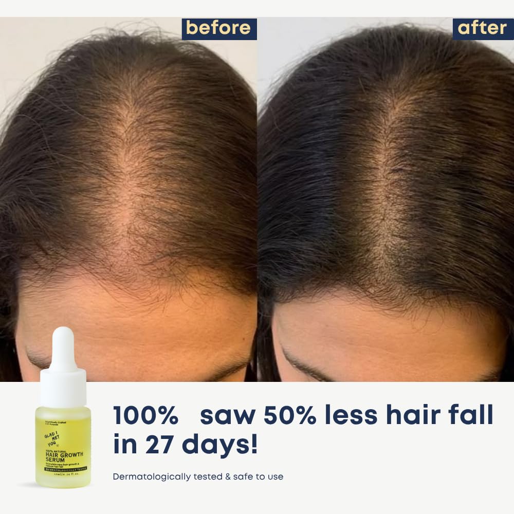Glad I Met You Hair Growth Serum With Rosemary, Castor, Sunflower + 50 More Active Oils | Hair fall control serum for Men & Women | Promotes Hair Growth | Dermatologically Tested | 10ml 2