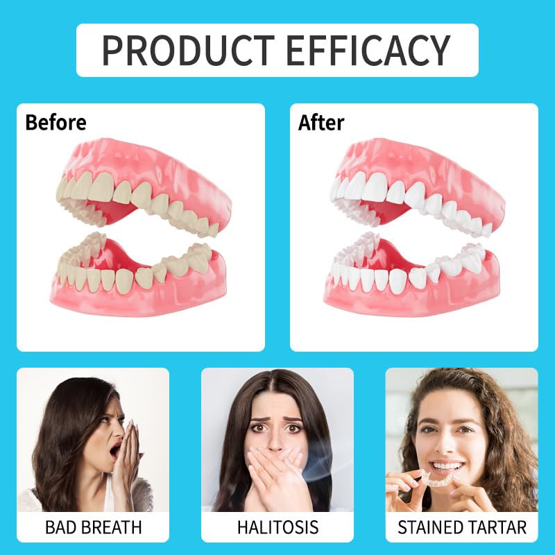 Retainer Pastiglie Detergenti,Compresse Pulizia Dentiere Effervescenti,Compresse Apparecchi Ortodontici,Compresses Pulitore Per Protesi,Rimuove Macchie E Odori,2pc