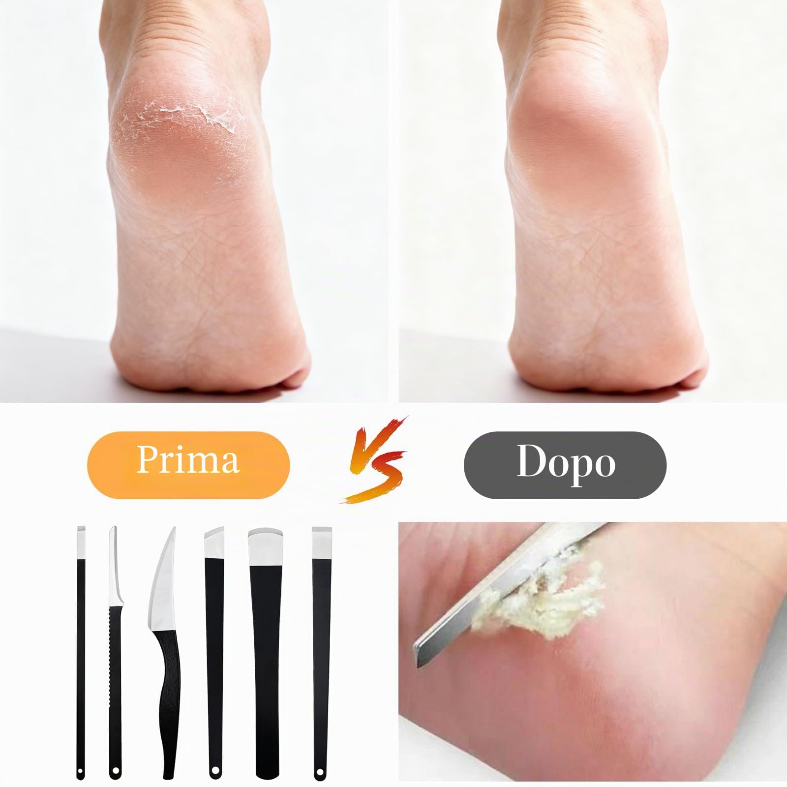 6 Pezzi Bisturi per Pedicure, Kit Pedicure Professionale per Piedi in Acciaio Inox, Set Coltelli da Pedicure con Custodia, Attrezzi Manicure Pedicure per Rimuovere Calli Duroni Pelle Morta Cuticole