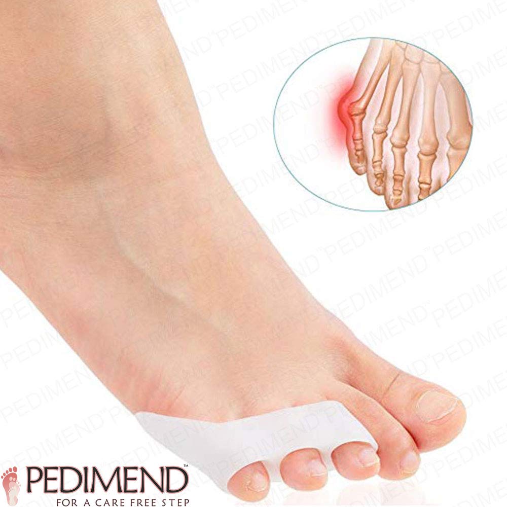 PEDIMEND Zehentrenner und Glätteisen aus Silikongel (1 Paar – 2 Stück), Zehentrenner für überlappende Zehen, Tailorenschutz, Unisex, Fußpflege