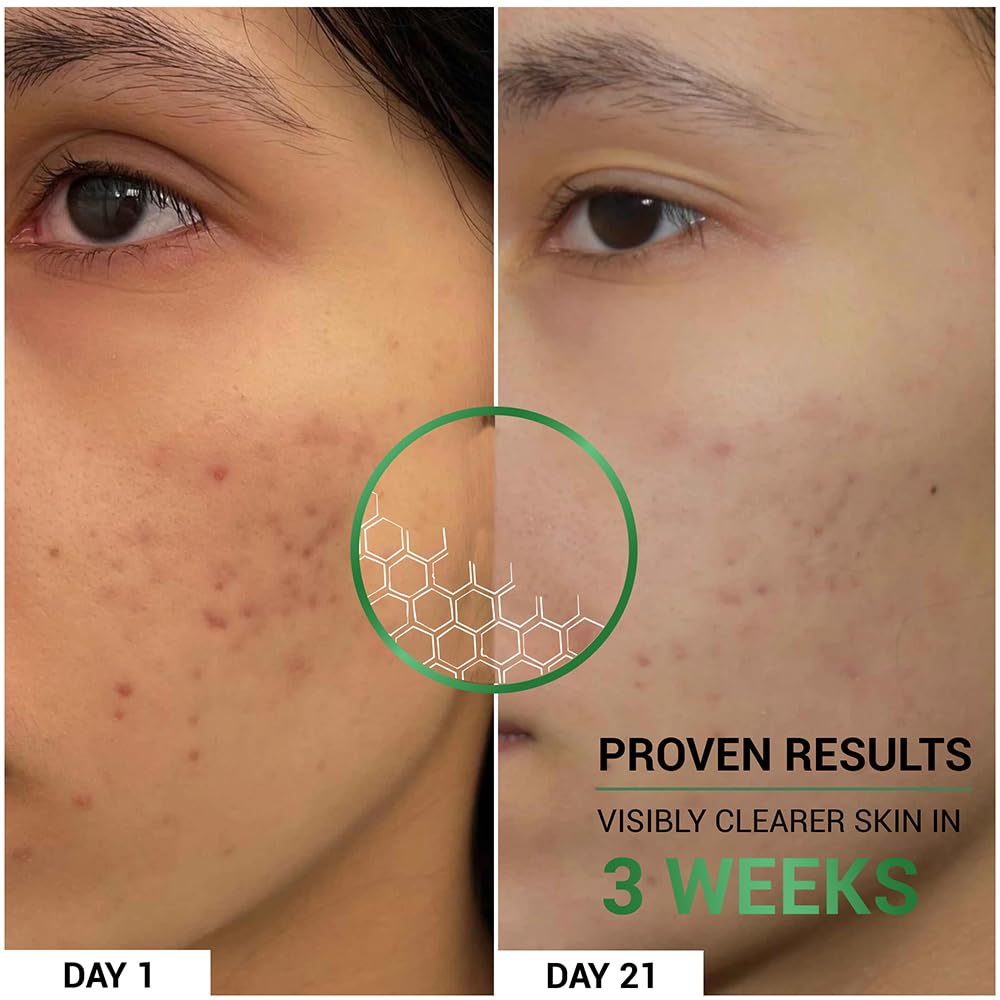 SEREKO Pore Clearing Face Wash with 1% Salicylic & Lactic Acid | Sulfate-Free Foaming Cleanser for Oily, Acne-Prone Skin | Deep Cleansing, Sebum Control & Gentle Exfoliation,Sulfate-Free β 100ml 3