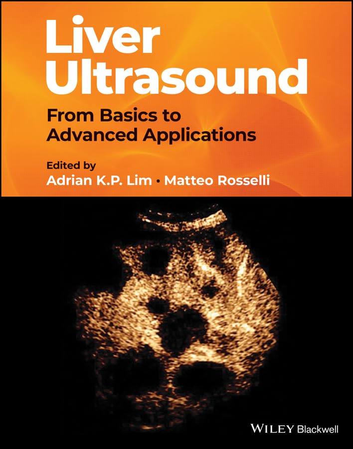 Liver Ultrasound: From Basics to Advanced Applications (English Edition)