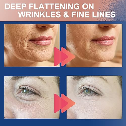 Miniatura 9 de Parches antiarrugas para frente y entre los ojos, el parche antiarrugas original no invasivo, suavizadores de arrugas para la frente y arrugas de
