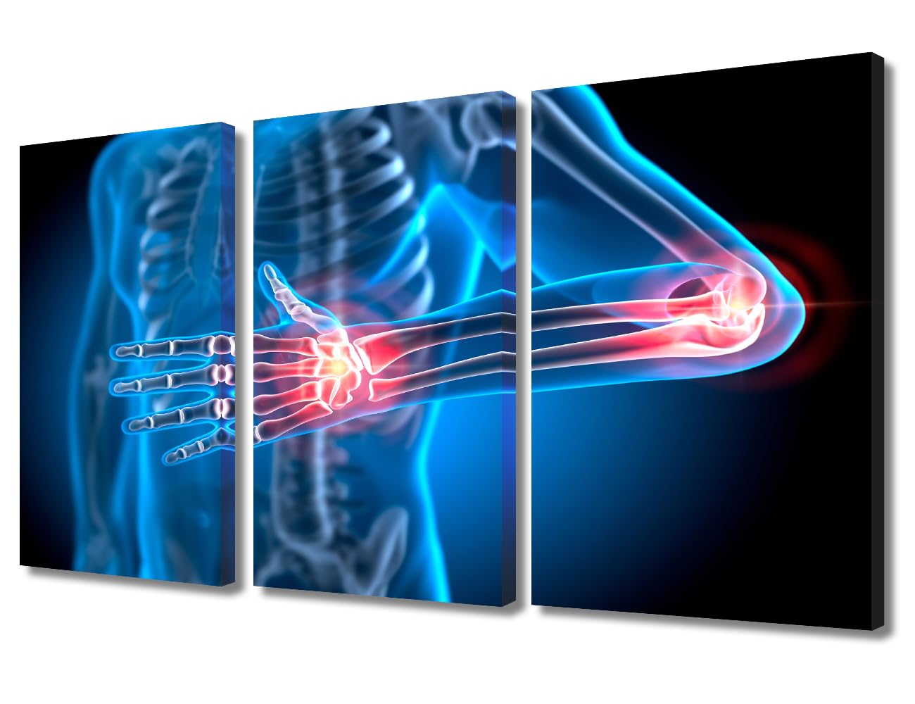 Wall Art Painful Hand and Elbow Joints Wall Art Bedroom 3 Panels X Ray Wall Prints Prints for Wall Decor Clinical Laboratory Posters &amp; Prints Giclee Print Gallery Packaging Artwork (36"Wx24"H)