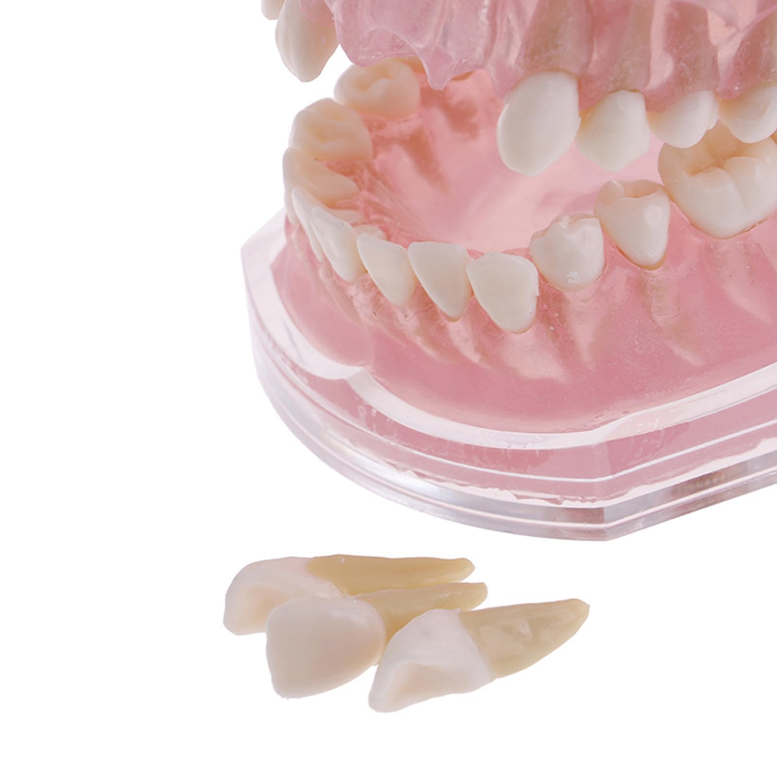 Modelo dental con dientes extraíbles, bandeja suave estándar, modelo dental extraíble, herramienta de enseñanza de materiales de laboratorio dental ideal
