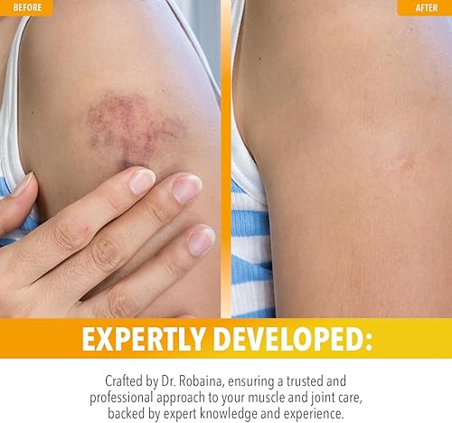 Miniatura 4 de Dr. Robaina Arnica Bruise Roll-On de 3 onzas  Arnica Montana de grado USP y vitamina K  Rodillo de secado rápido y sin desorden que reduce