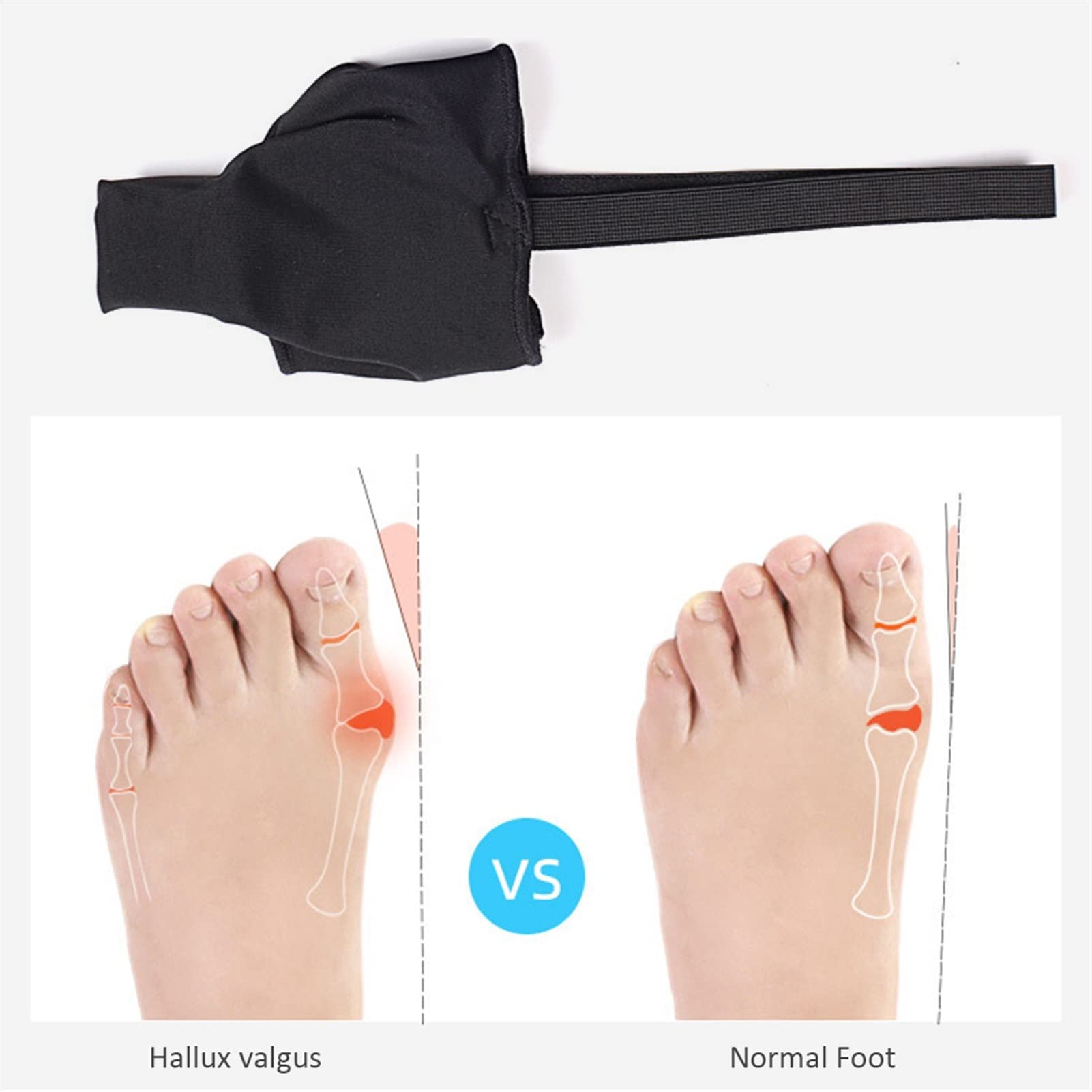 Raddrizzatore per Dita del Pollice Separatore per Alluce valgo Correttore Pad Stretch Alluce valgo Protezione per Dita dei Piedi Ortopedico per Donne e Uomini (Champagne S)
