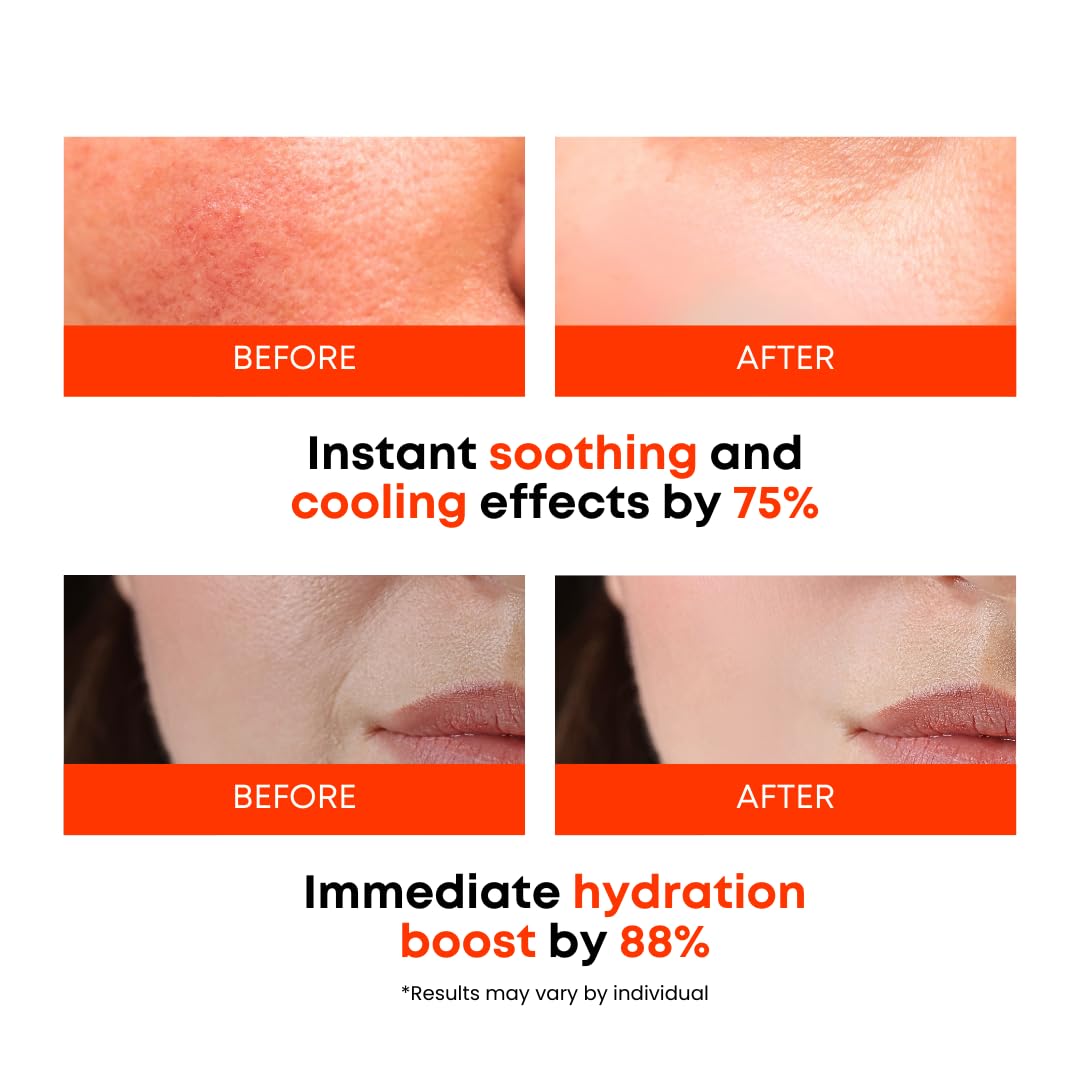 Carrot Calming Toner Pads – Korean Toner Pads with Centella Asiatica, Redness Reducing Skin Care, Pore Minimizer, Soothing & Hydrating with Jeju Carrot Extract, 100% 7 Layer Cotton 40 Pad - Image 4