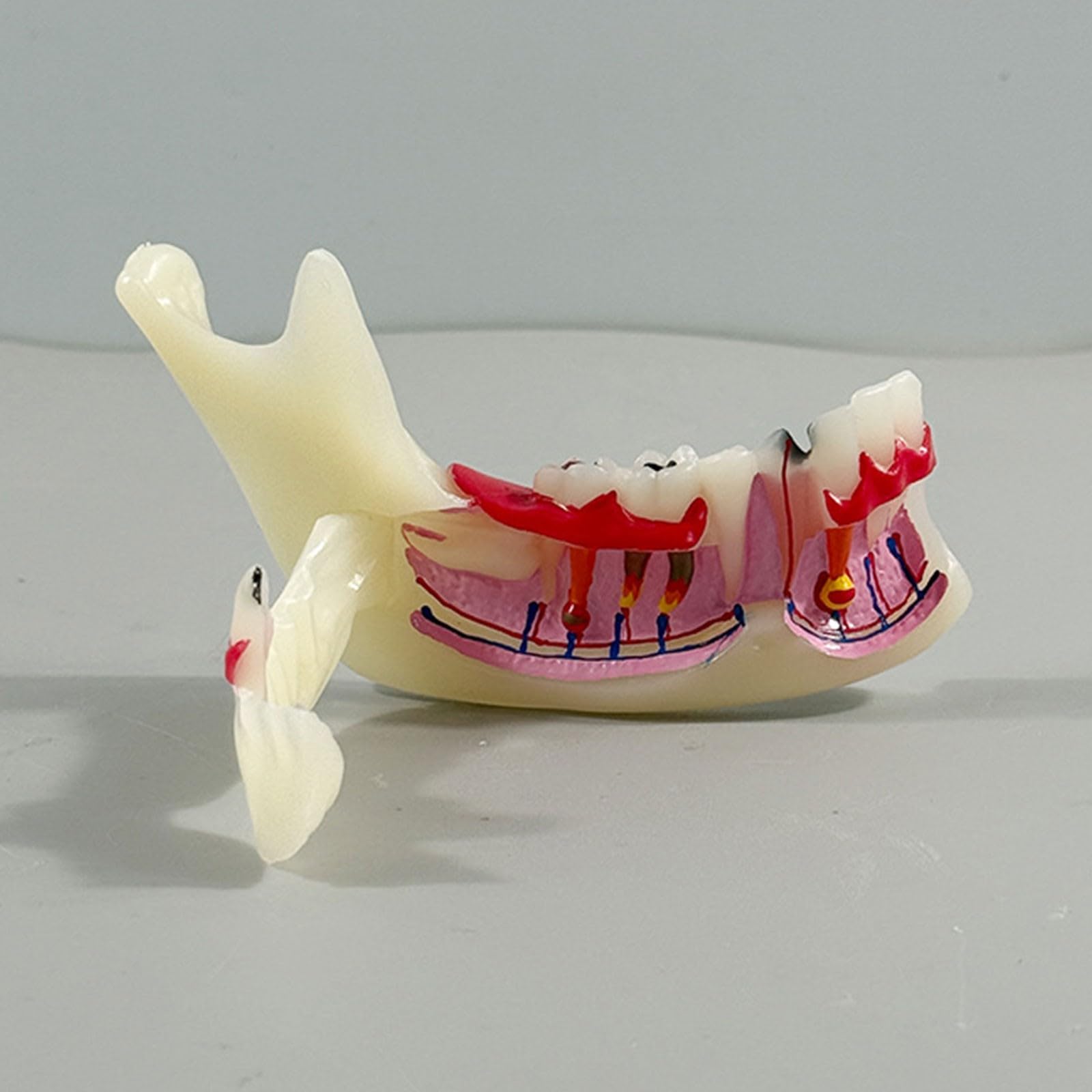 Modello di denti Typodont per l'educazione orale, strumento dimostrativo per lo studio della carie e della cisti radicale, aiuto didattico anatomico per dentisti