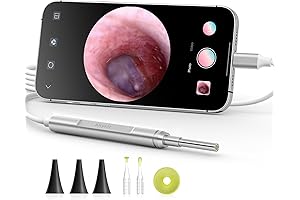 Anykit Digital Ear Magnifier with Light: Visualize Your Ear's Inner Workings