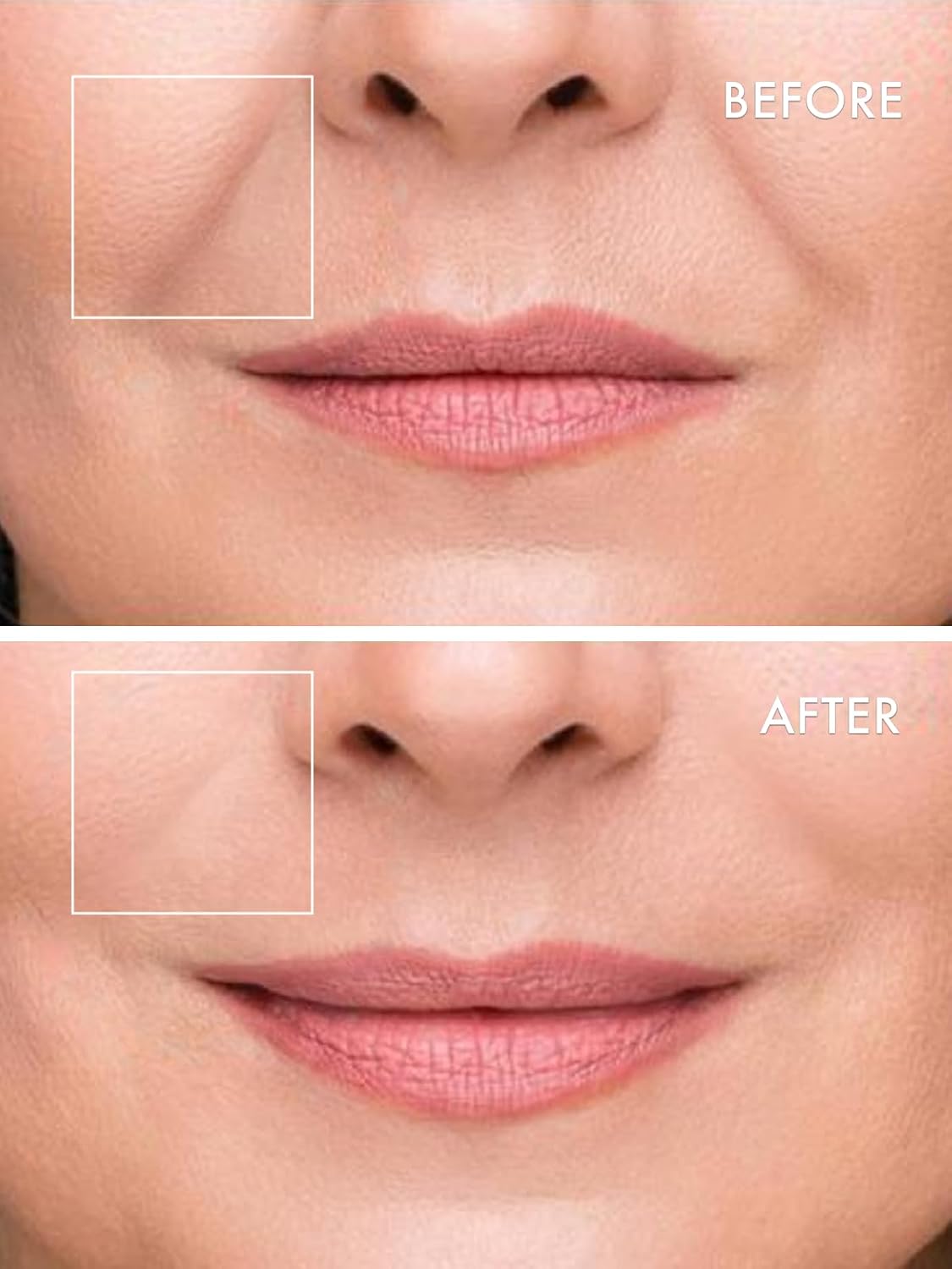 depology Deepcare+ Serum-Infused Micro Dart Patche | 4 Pairs Eye Mask | Under Eye Patches for Wrinkles | Fine Lines | Hydrating Eye Mask with Peptides | Amino Acids | and Synthesized Molecules - Image 6