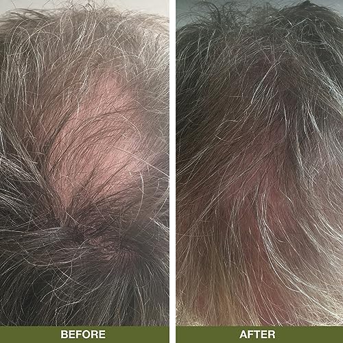 Hair loss Shampoo 200ml with Lemon | Ideal for anyone experiencing hair loss or has very fine, thin hair | Stimulates hair growth, Great for slow growing hair – For Men and Women… - Image 5