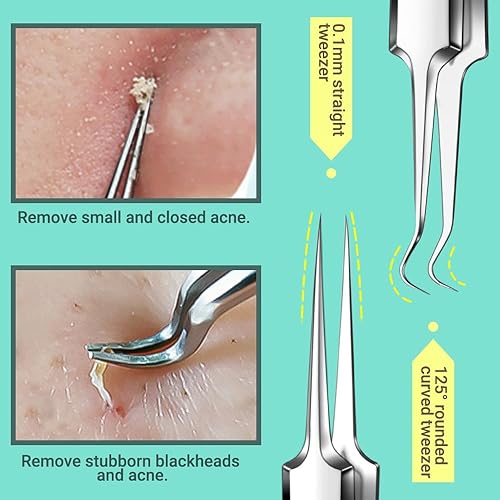 Miniatura 3 de TsMADDTs Herramientas para eliminar puntos negros y pinzas de pelo encarnado, kit de herramientas de 9 piezas, kit de depilación encarnada con