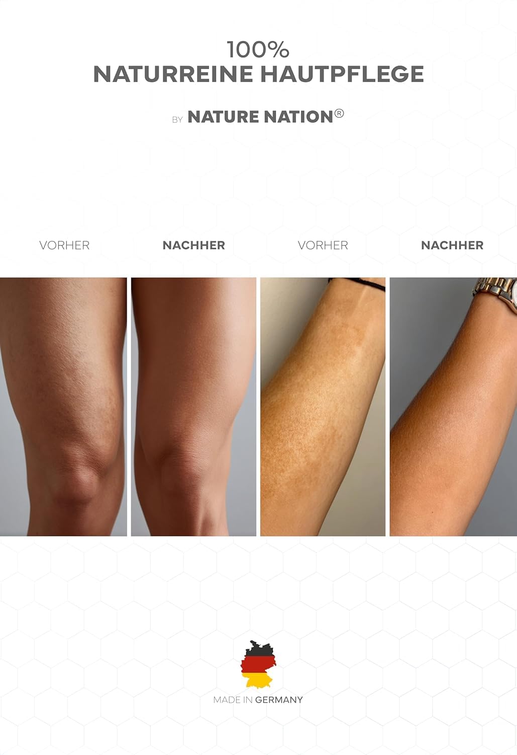 Bienengiftsalbe hochdosiert (+70% Melittin): Kühlend & wärmend, Bee Venom Bienengiftcreme + 9 Kräuterextrakte & 330 Bienenstichen: Aloe Vera & Eukalyptus; Made in Germany; Pflegt Falten & Arthrose