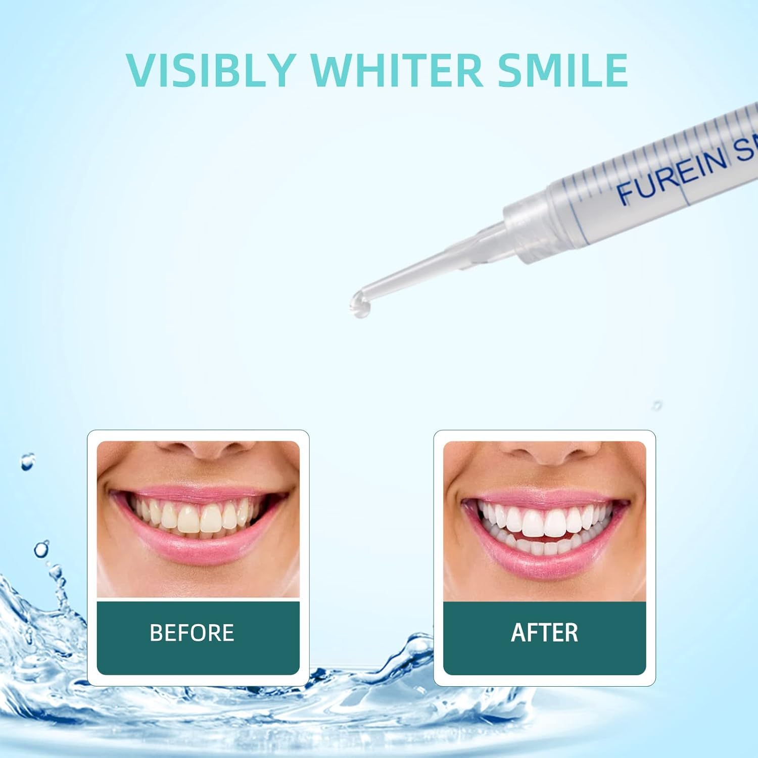 Kit Profesional de Blanqueamiento Dental en Casa 32 LED Luz Azul Juego de Blanqueamiento de Dientes 4 Lápices Blanqueadores PAP Gel Kit de Blanqueamiento Dental