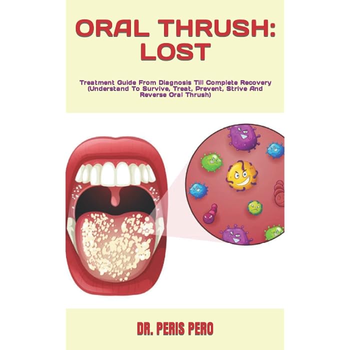 Buy ORAL THRUSH LOST Treatment Guide From Diagnosis Till Complete Recovery (Understand To