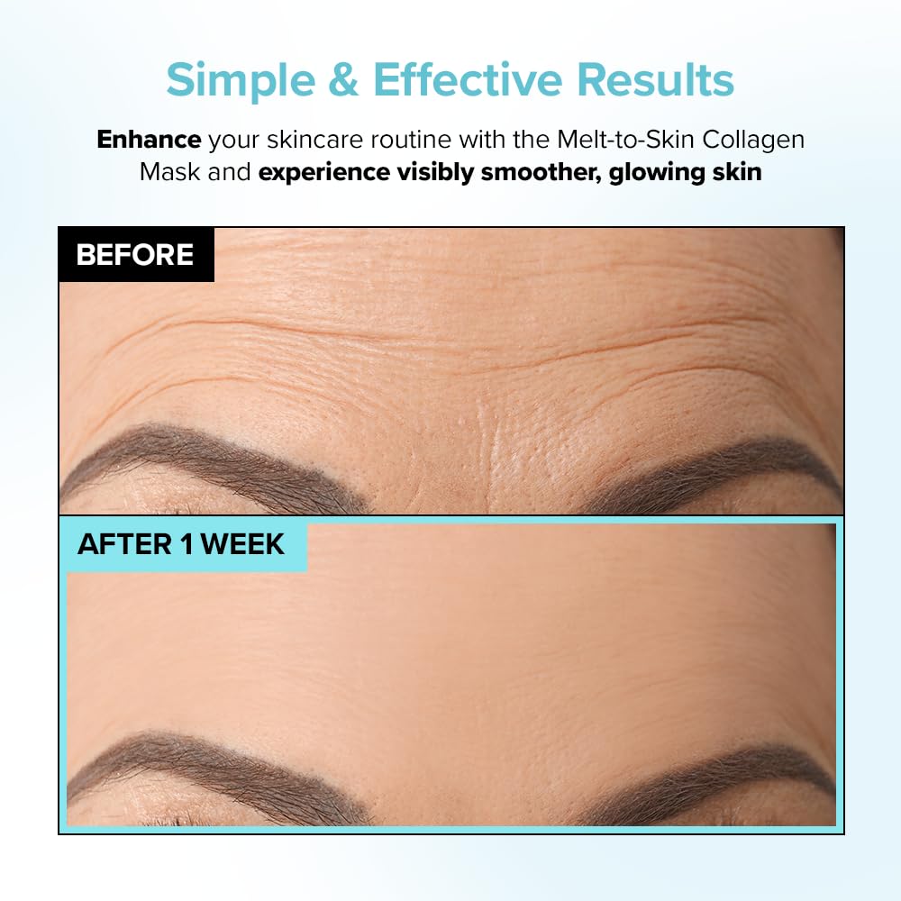 Melt to Skin Collagen Facial Wrinkle Patches