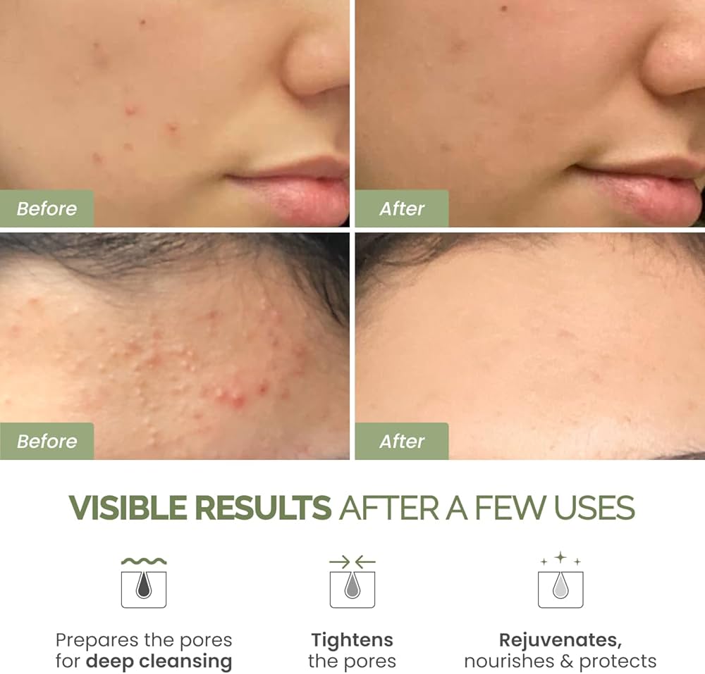 Amazon.com : PLANTIFIQUE Korean Skincare Clay Mask – Hydrating Mud