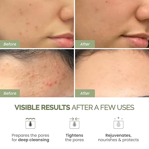 Miniatura 7 de PLANTIFIQUE Mascarilla coreana de desintoxicación para el cuidado de la piel con aguacate y línea en V, 5 unidades