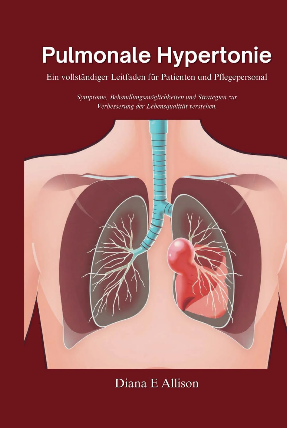 Pulmonale Hypertonie: Ein vollständiger Leitfaden für Patienten und Pflegepersonal: Symptome, Behandlungsmöglichkeiten und Strategien zur Verbesserung ... (The Complete Health Guide Collection)