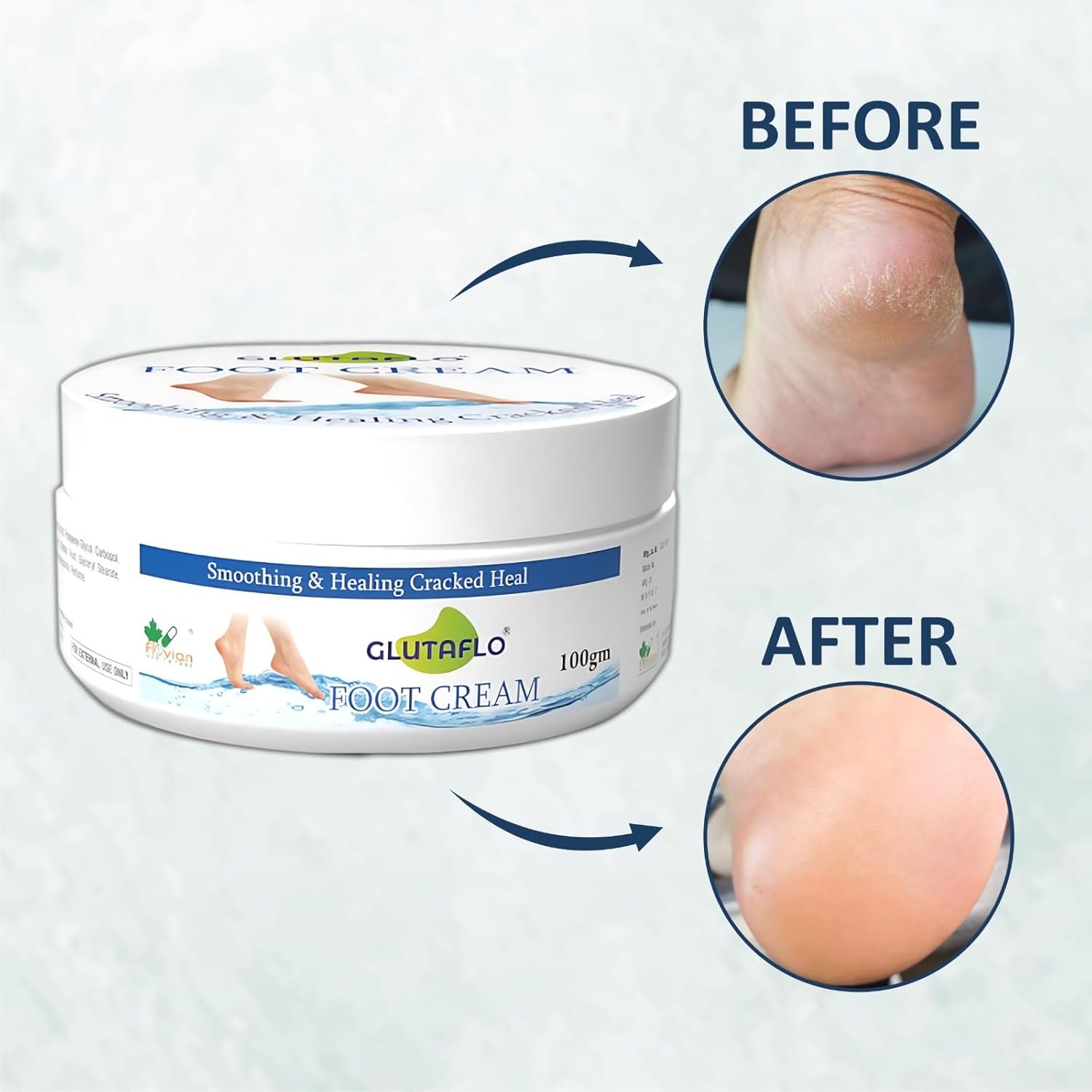 Glutaflo Foot Cream For Rough, Dry and Cracked Heel, Feet Cream For Heel Repair With Benefits of Urea, Lactic Acid and Vitamin E All Skin Types 100 Gm. Glutaflo Foot Cream For Rough, Dry and Cracked Heel, Feet Cream For Heel Repair With Benefits of Urea, Lactic Acid and Vitamin E All Skin Types 100 Gm.