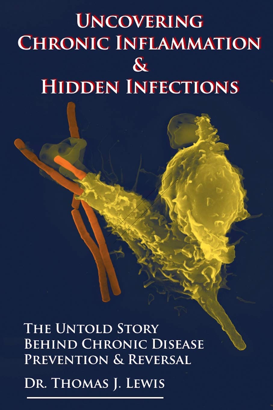 Uncovering Chronic Inflammation & Hidden Infections: The Untold Story ...