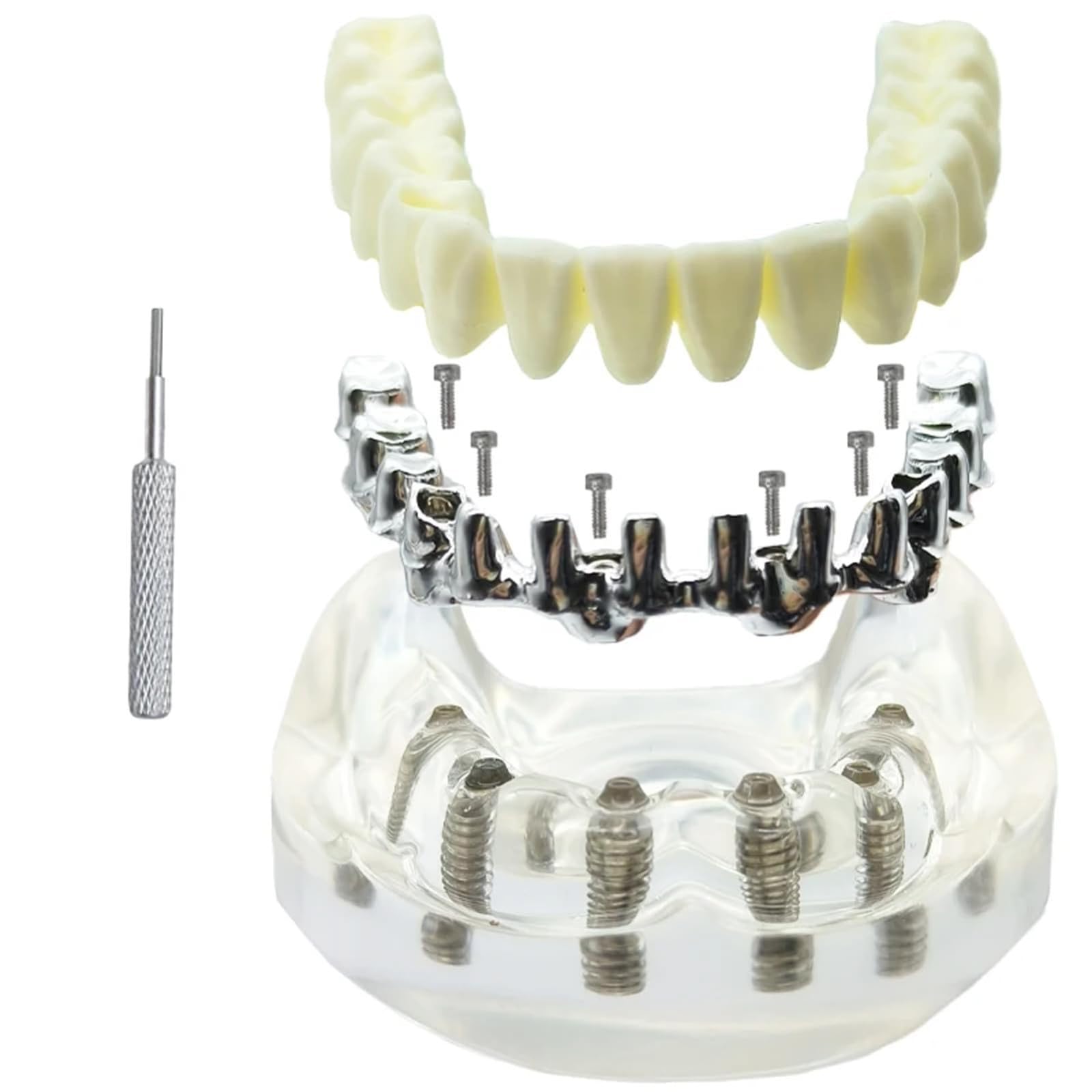 Modello di impianto dentale overdenture mascella inferiore rimovibile con 6 impianti per studio didattico - Strumento di dimostrazione della visione trasparente