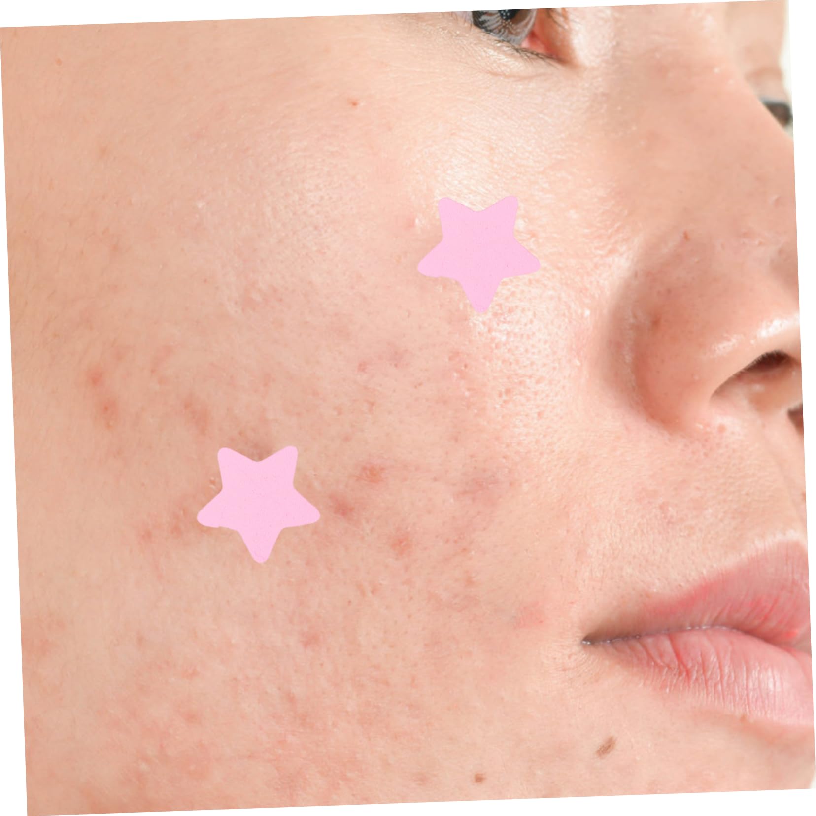 Ipetboom 20hojas Parches Hidrocoloides Transpirables Para Acné Parches Para Espinillas Diseño De Para Facial y Cuidado De Cicatrices