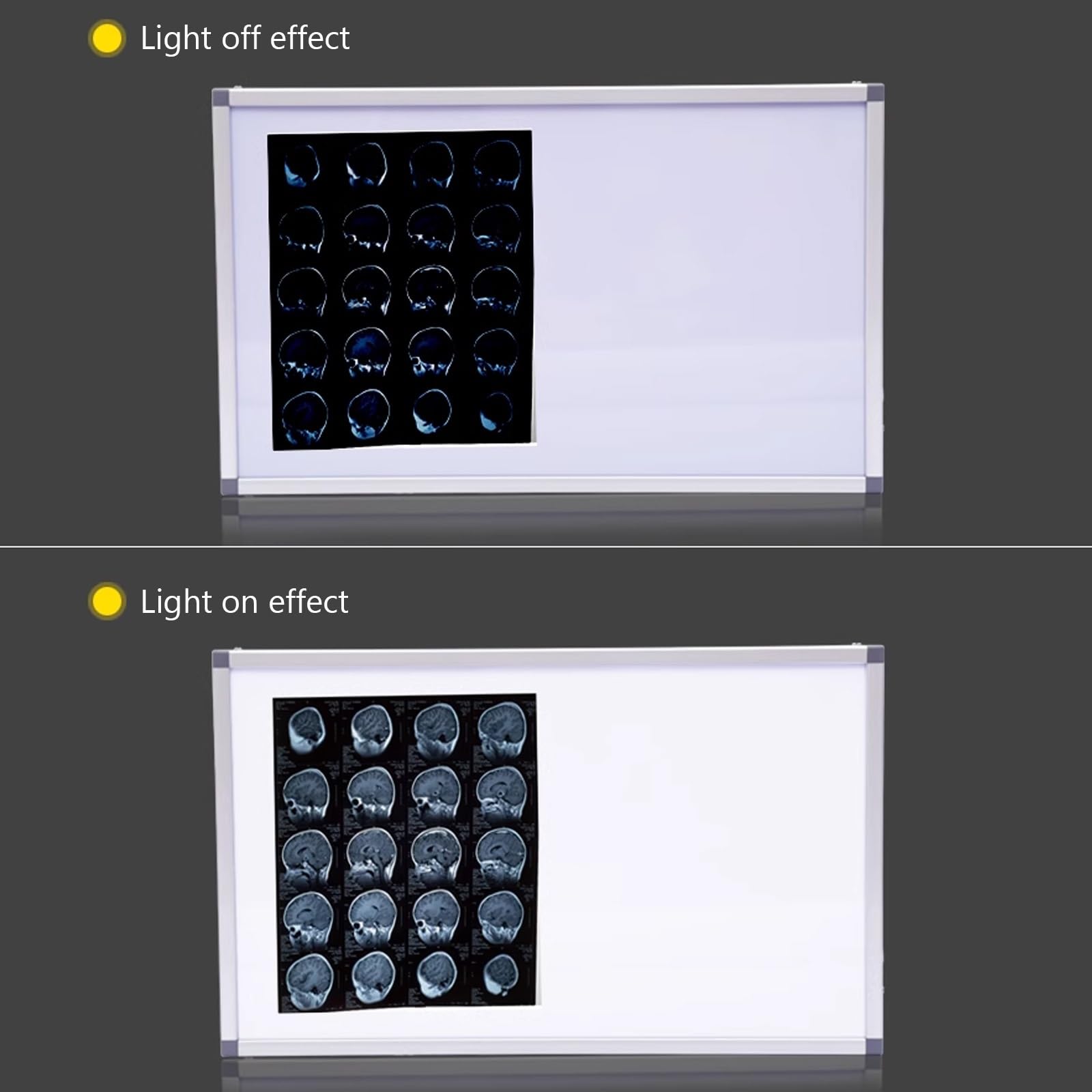 Boîte Lumineuse D'illuminateur de Film à Rayons X Portable, Négatoscope for Équipement Médical Orthopédique à Luminosité Réglable