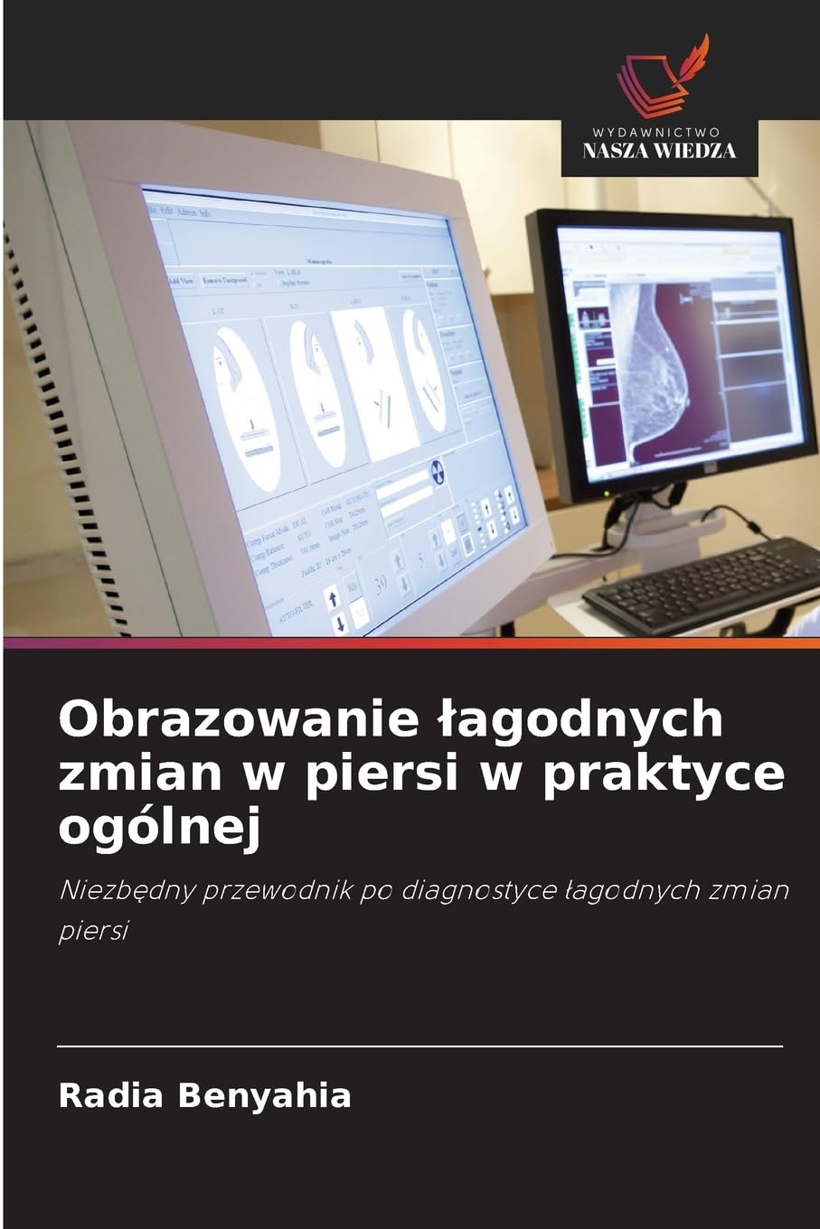 Obrazowanie lagodnych zmian w piersi w praktyce ogólnej: Niezb¿dny przewodnik po diagnostyce ¿agodnych zmian piersi