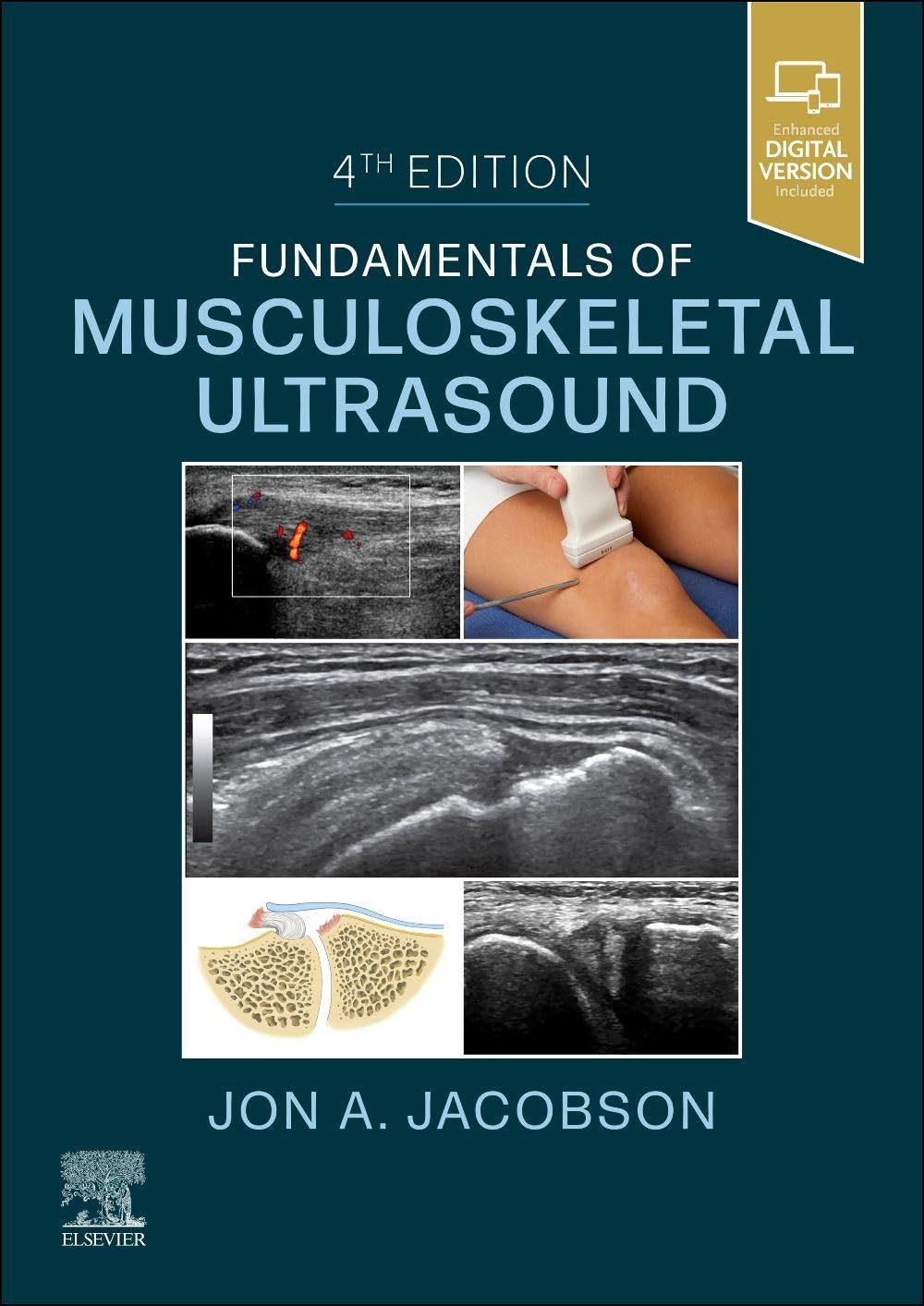 Fundamentals of Musculoskeletal Ultrasound (Fundamentals of Radiology)      4th Edition