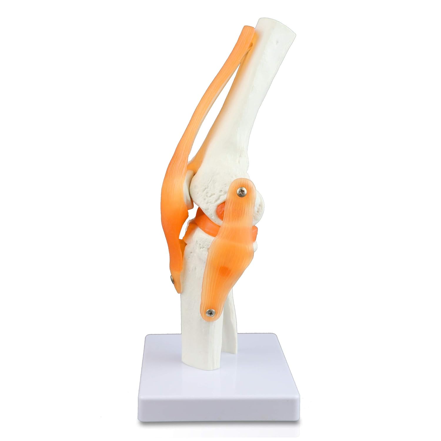 Vision Scientific VAJ212 Classic Functional Knee Joint, Articulate with Life-Like Synthetic Ligaments, Duplicating Half of Femur, Patella, Proximal Tibia and Fibula