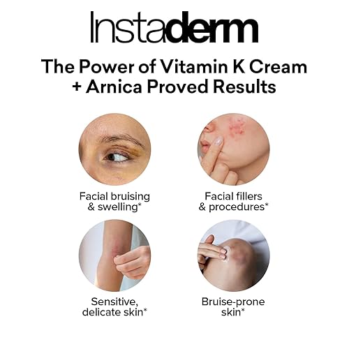 Miniatura 4 de Crema de vitamina K, fórmula curativa de moretones con árnica. Humectante de manchas oscuras para moretones, arañas vasculares y capilares rotos.