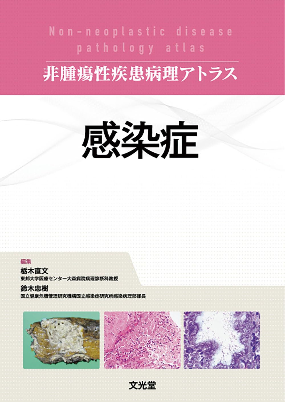精巣腫瘍病理アトラス 裁断済み 造血器腫瘍 第2版(腫瘍病理鑑別診断アトラス) | 加留部謙之輔, 倉田盛