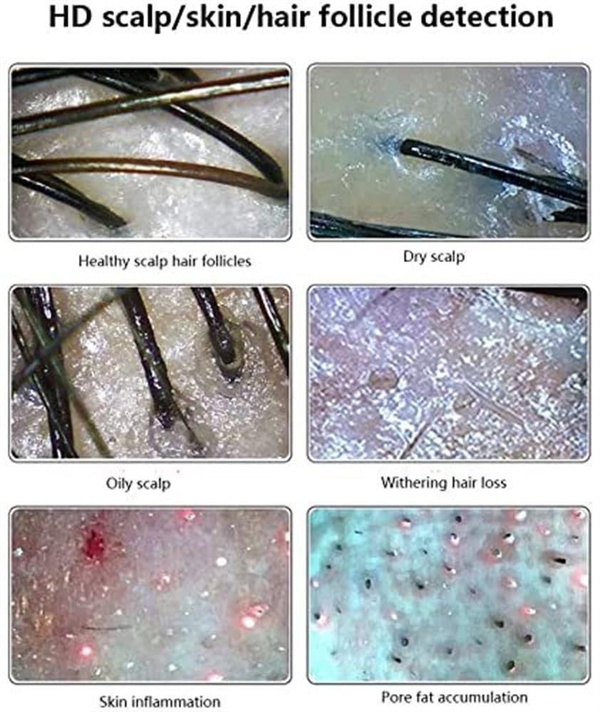 Analizzatore della salute della pelle con rilevatore del cuoio capelluto, schermo Ultra HD da 11 pollici con quattro funzioni di analisi dello spettro for la cura della pelle al microscopio, macchina