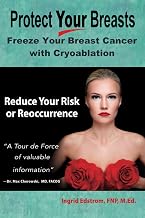 Protect Your Breasts: Freeze Your Breast Cancer with Cryoablation, Reduce Your Risk or Reoccurrence