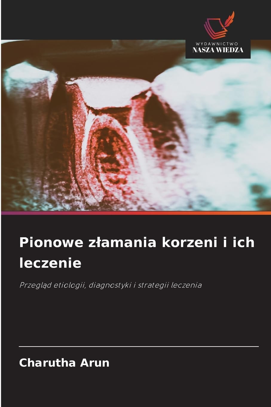 Pionowe zlamania korzeni i ich leczenie: Przegl¿d etiologii, diagnostyki i strategii leczenia