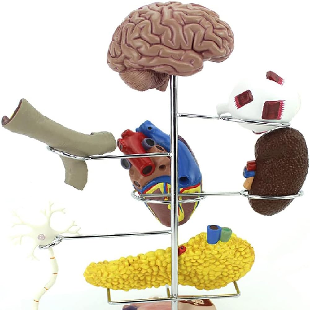 Diabète Pathologique, Modèle D'organe Humain, Modèle Anatomique De Diabète 8 Pezzi, Thrombose Coronarienne Artériosclérose Montrer Utile