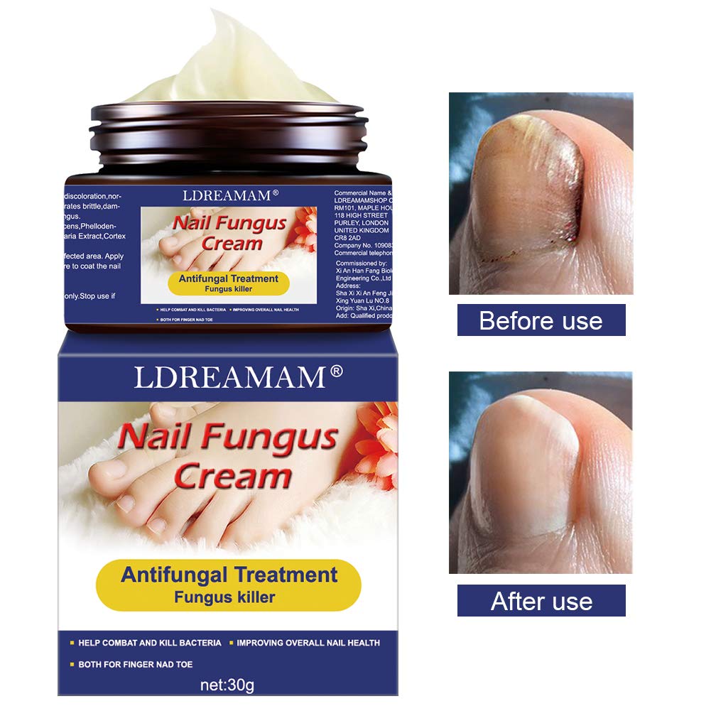 Buy Fungus Stop,Nail Fungus ,Nail Repair Cream Fingernails Solution