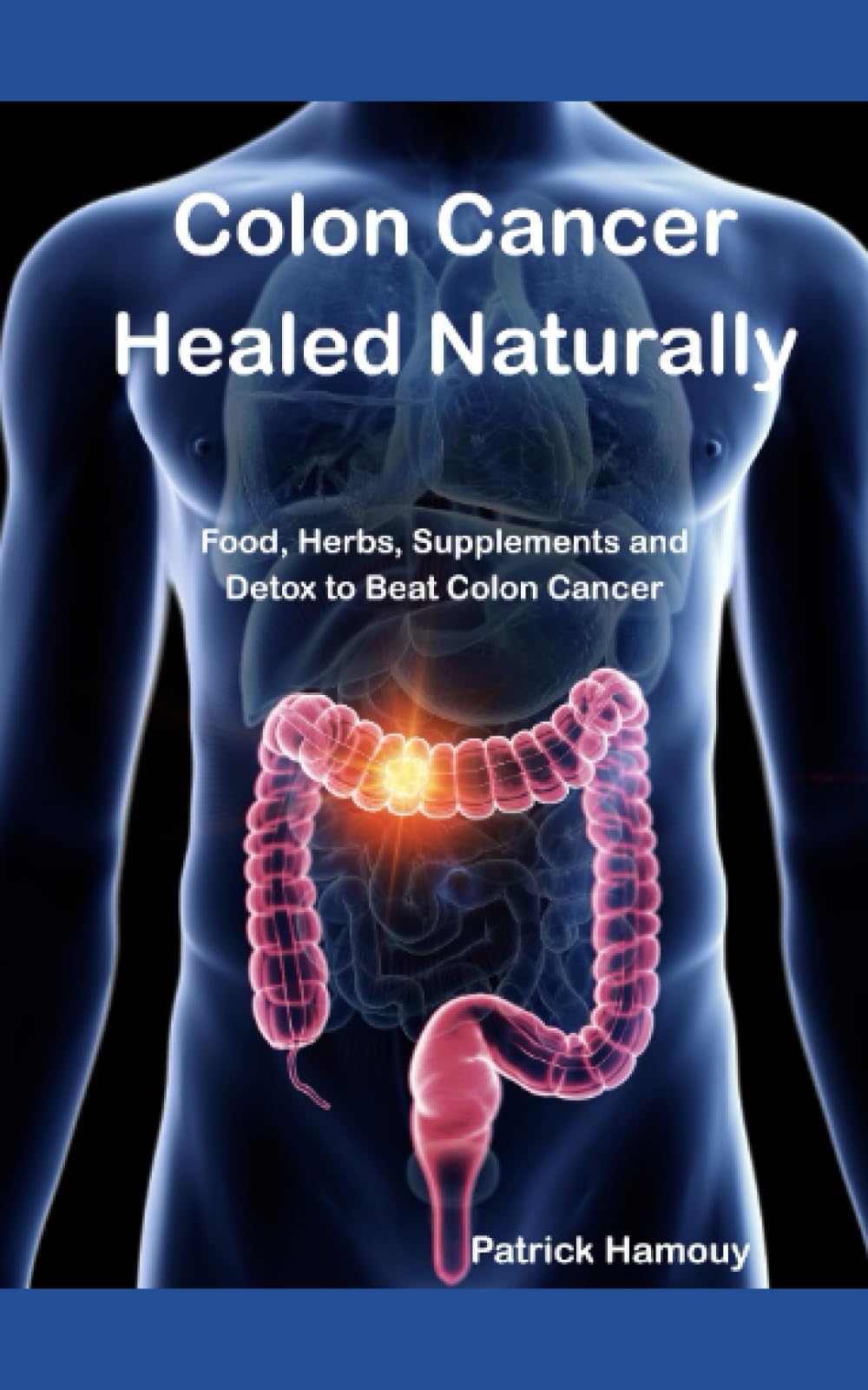 Colon Cancer Healed Naturally: Food, Herbs, Supplements and detox to beat Colon Cancer