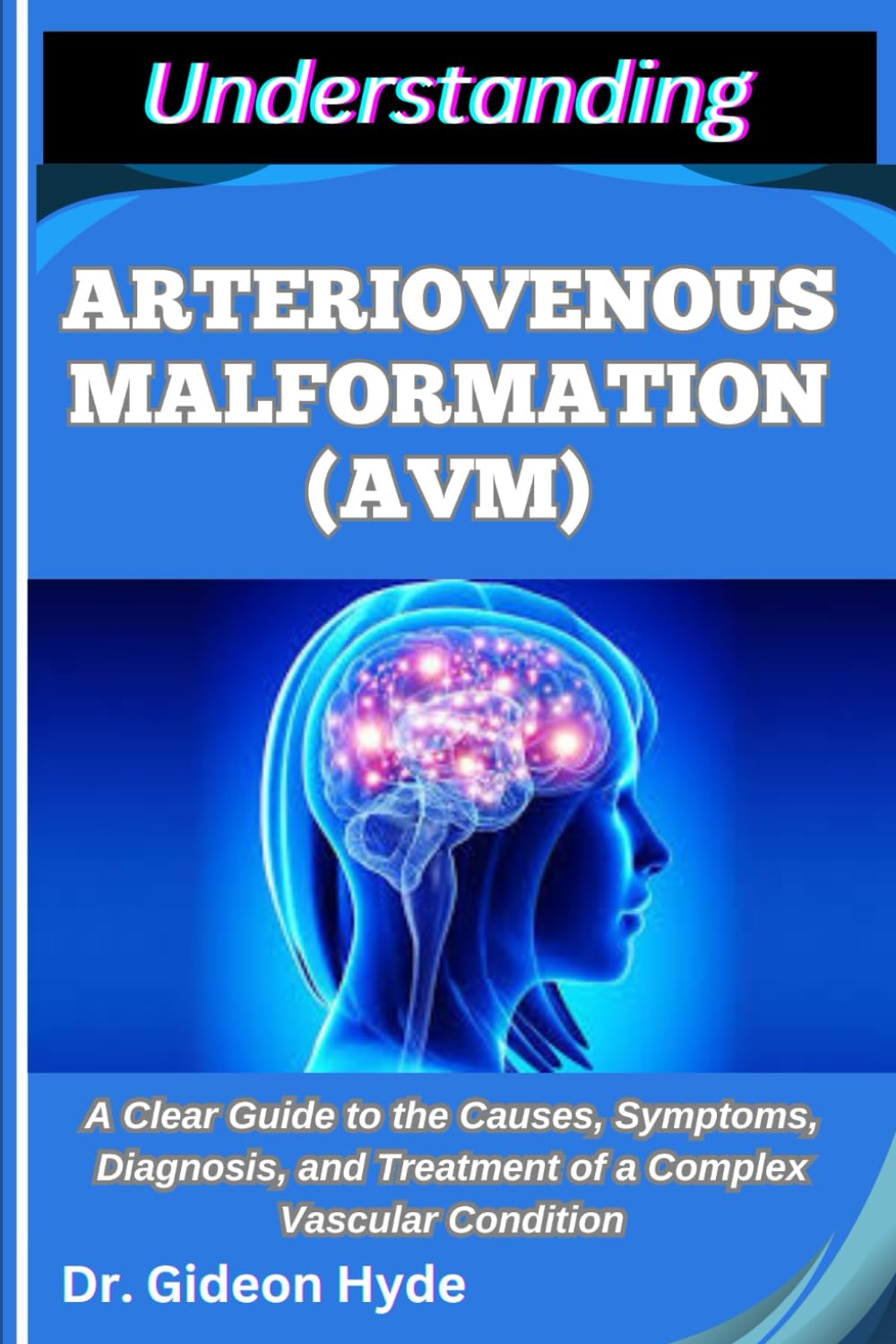 UNDERSTANDING ARTERIOVENOUS MALFORMATION (AVM): A Clear Guide to the Causes, Symptoms, Diagnosis, and Treatment of a Complex Vascular Condition