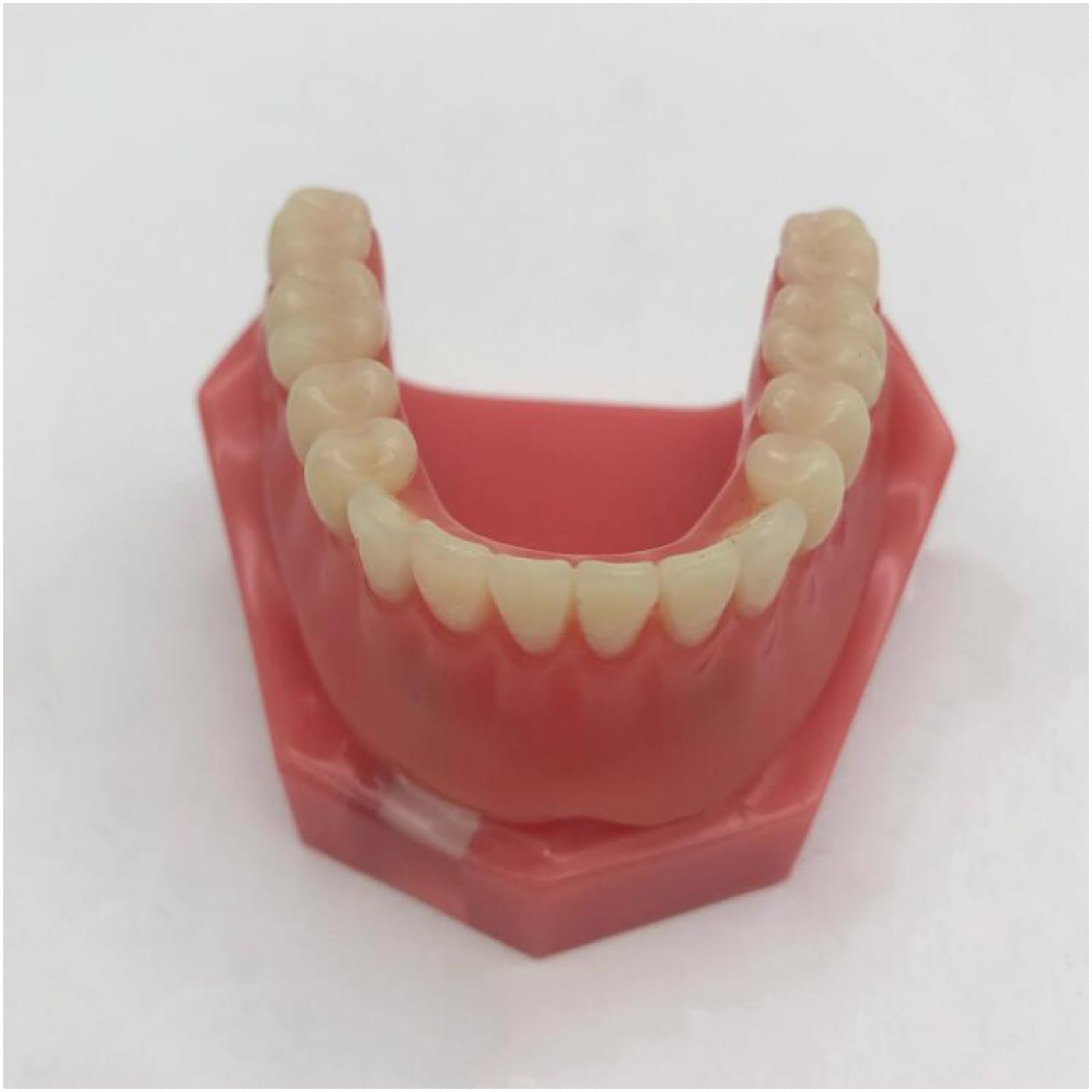 Modello di Denti dentali, Modello di restauro Dentale con 2 impianti, per Laboratorio odontotecnico di Ricerca didattica odontoiatrica