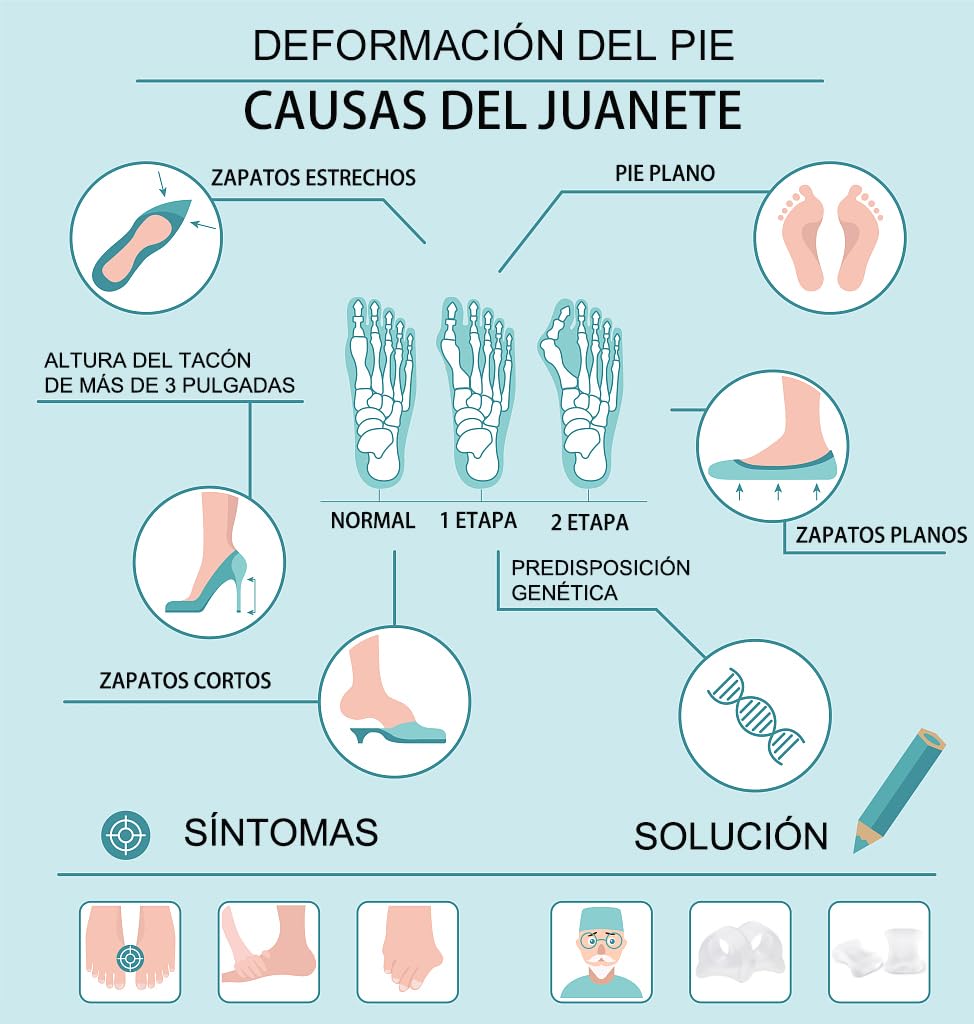 Separadores de dedos de gel 12 unidades corrector juanetes martillo dedos superpuestos