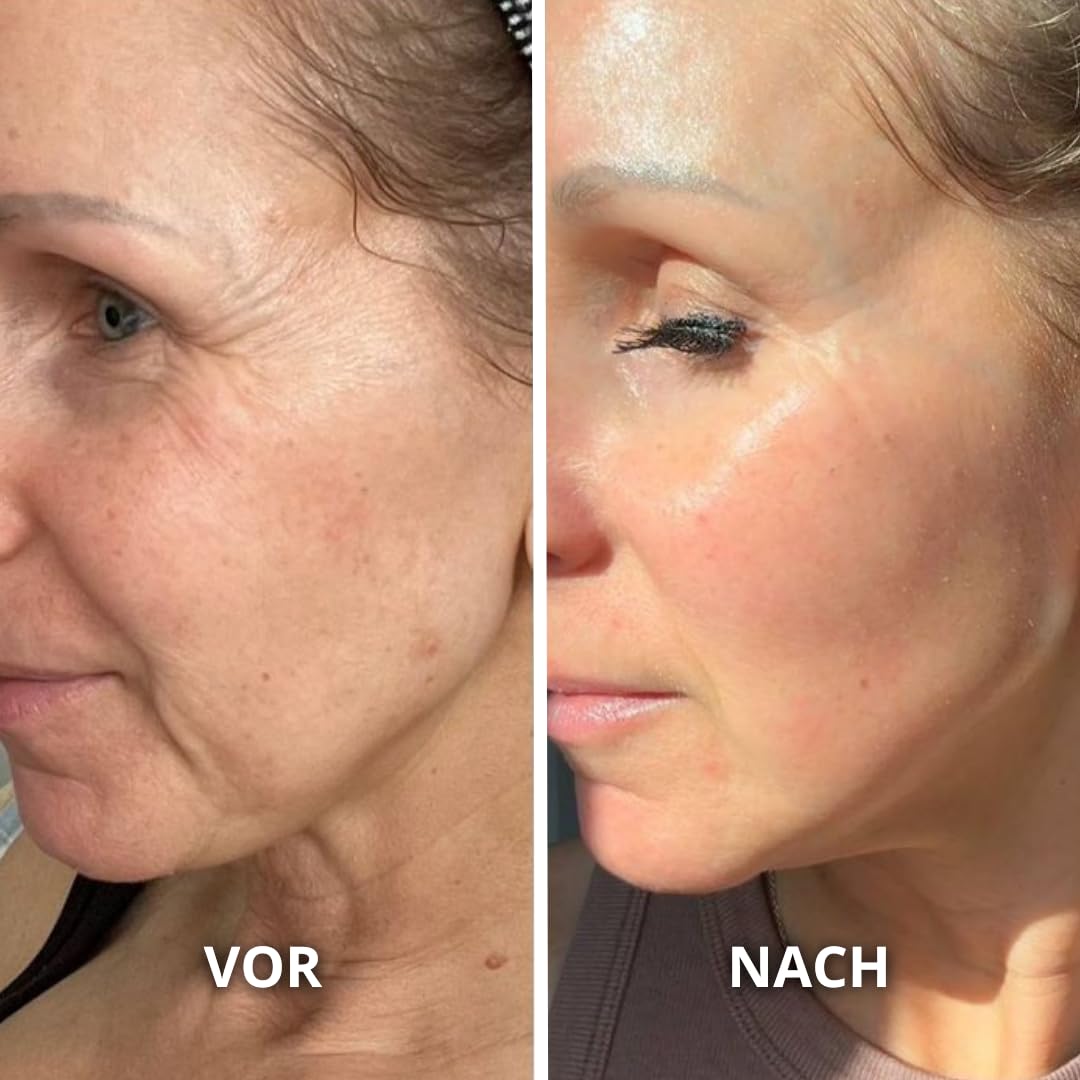 Bio Kaktusfeigenkernöl, 50 ml – Pipette – Glasflasche – 100% rein, natürlich, kaltgepresst – Bio-Kaktusfeigenöl, Anti-Aging und Anti-Augenringe