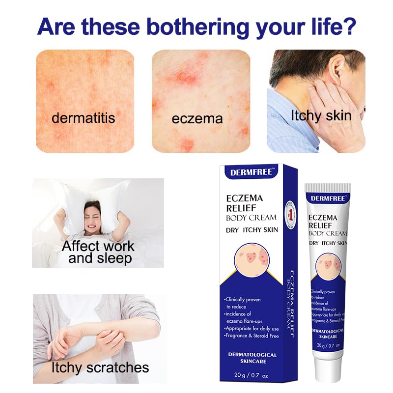 Eczema Care and Anti-itch Cream for Men and Women. Suitable for Dry and Eczema-prone Skin. Suitable for Itchy Skin, Wet Itching, Urticaria, Dermatitis. Unscented and Preservative-free. 20g - Image 3