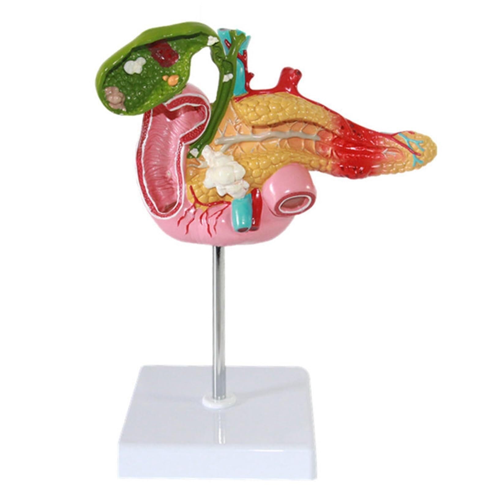HEQIM Life-Size Medical Education Digestive System Anatomy Teaching Model, Human Pancreas Duodenum Gallbladder pathological Anatomy Model, Medical Digestive System Teaching Model