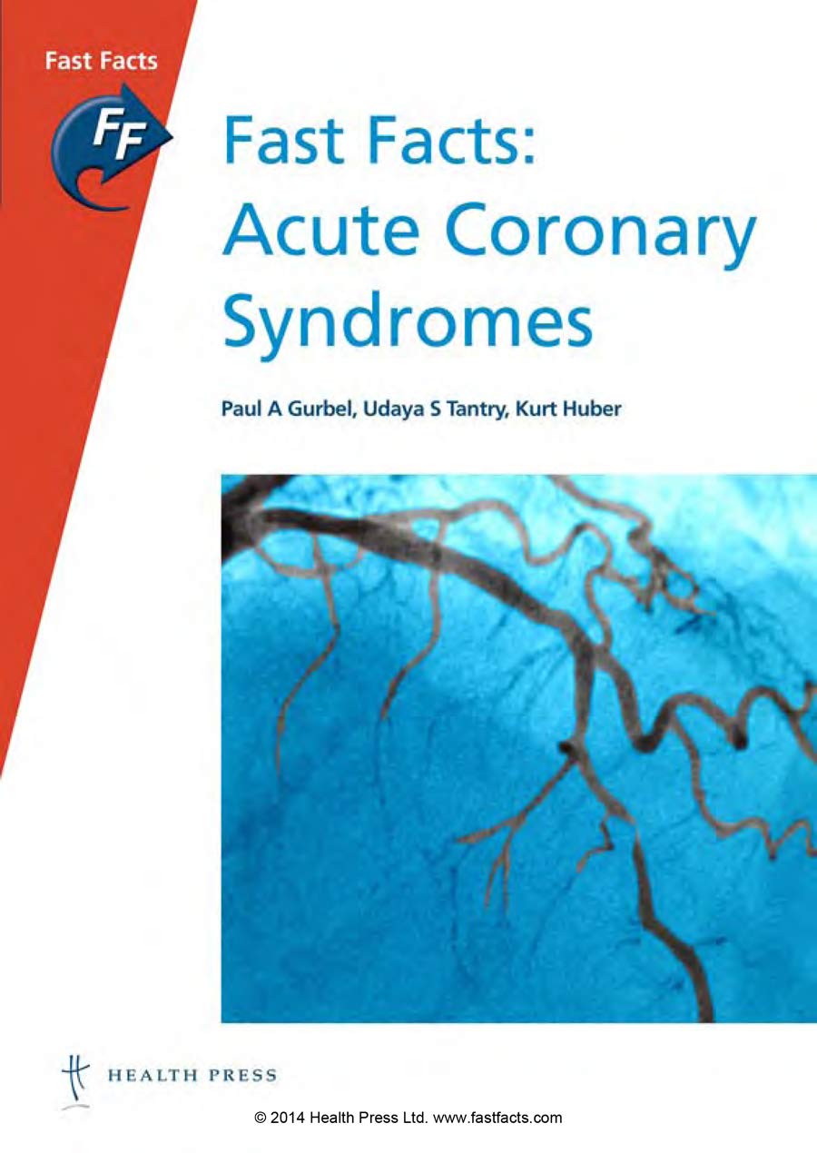 Buy Fast Facts: Acute Coronary Syndromes — BookShops.in