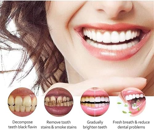 Miniatura 7 de Pasta de dientes blanqueadora SP-4 Probióticos, pasta de dientes Yayashi SP-4, pasta de dientes de aliento fresco, promueve dientes y encías